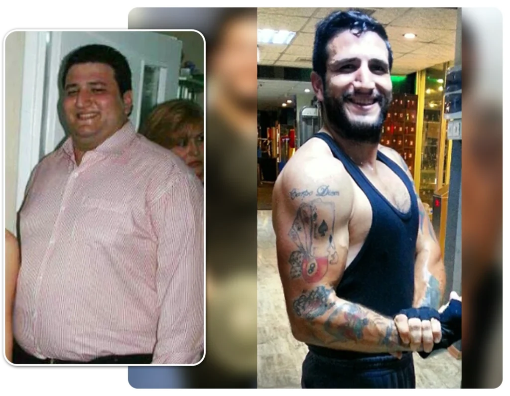 Chirurgie perte de poids: Avis Sleeve Gastrique Lucas M.