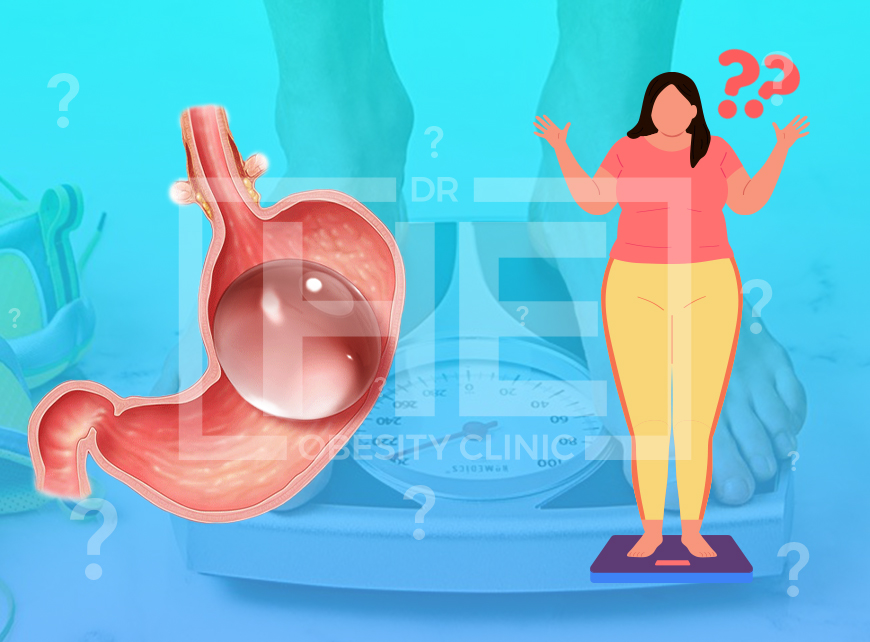 do you gain weight after gastric balloon