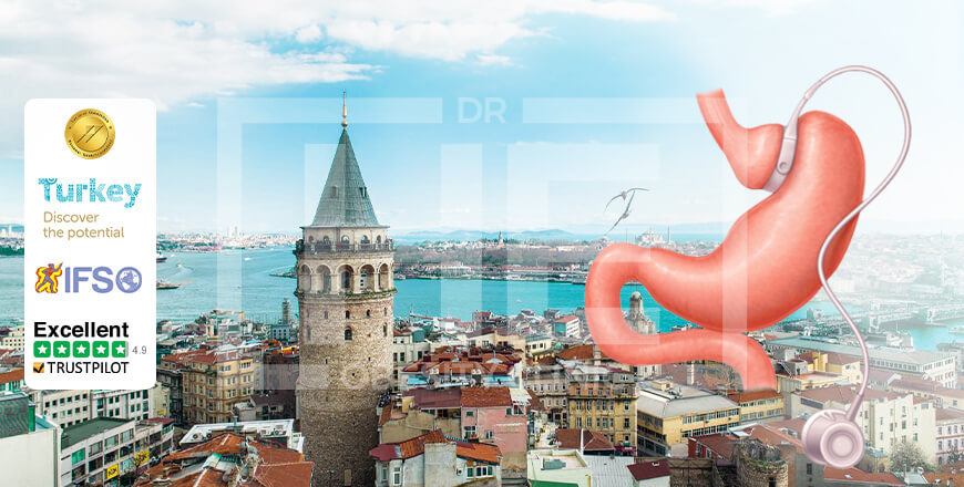 Gastric Band Surgery in Turkey